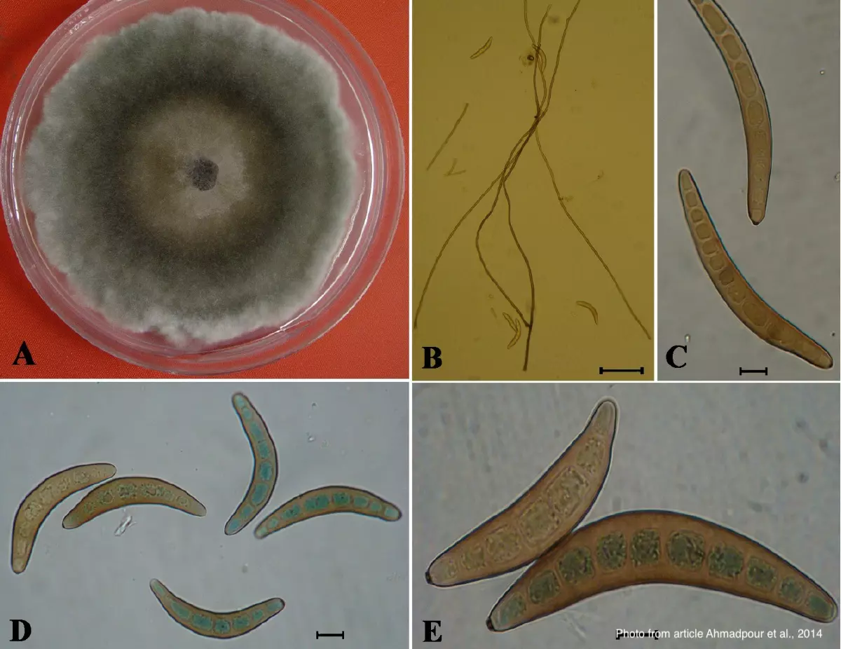 Внешний вид на колонию, конидиеносцы, конидии штамма A41 of Bipolaris oryzae: A) Колония, B) Конидиеносцы (Bar= 100 μm), C-E) Конидии (Bar= 10 μm).