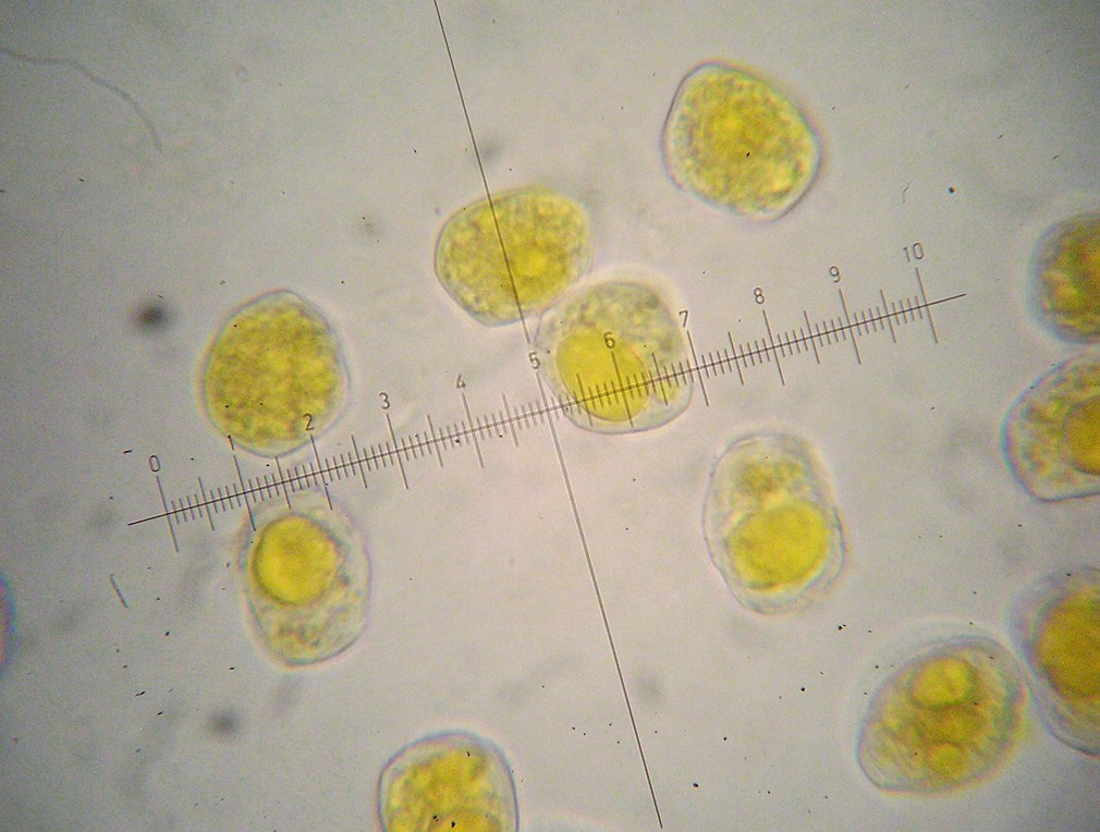 Aeziosporen 20-22 x 16-19 µm