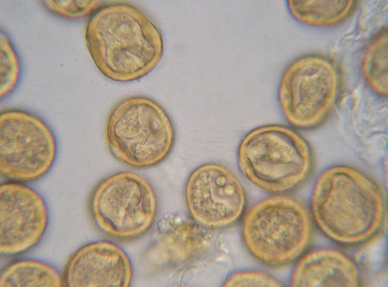 Uredosporen stachelig