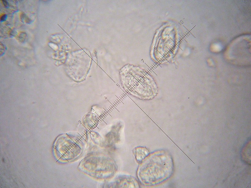 Teliosporen 26-29 x 14-16 µm