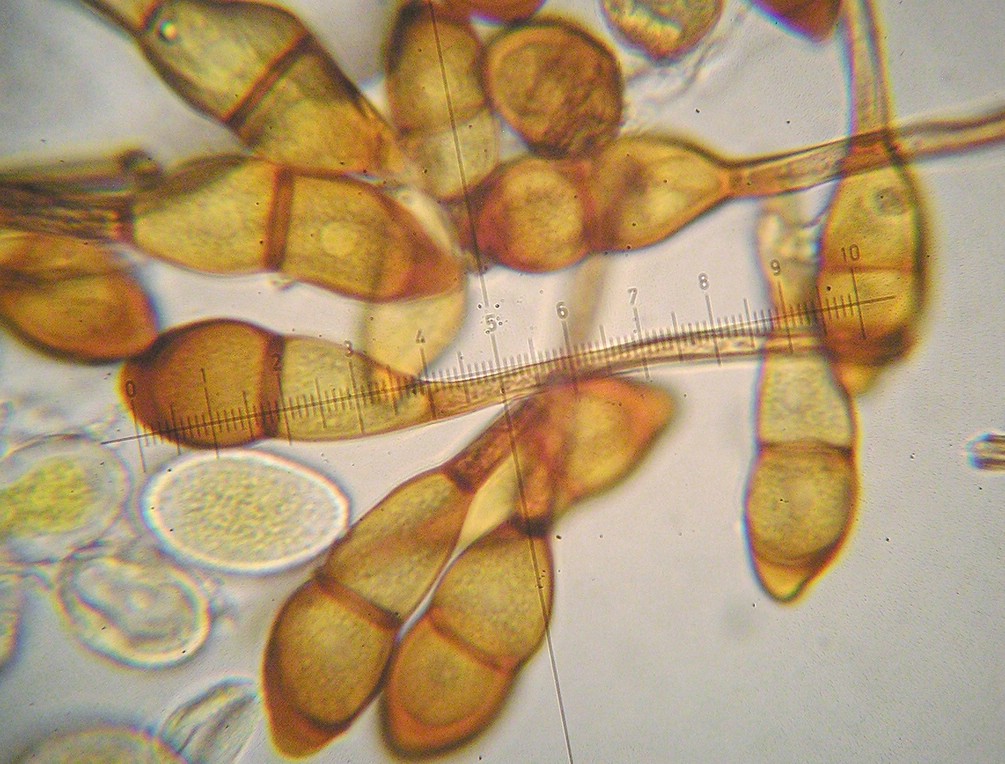 Teliosporen spindel- bis keulenförmig; am Scheitel gerundet oder zugespitzt (bis 10 µm); Sporen etwa 50 µm lang gestielt, fest