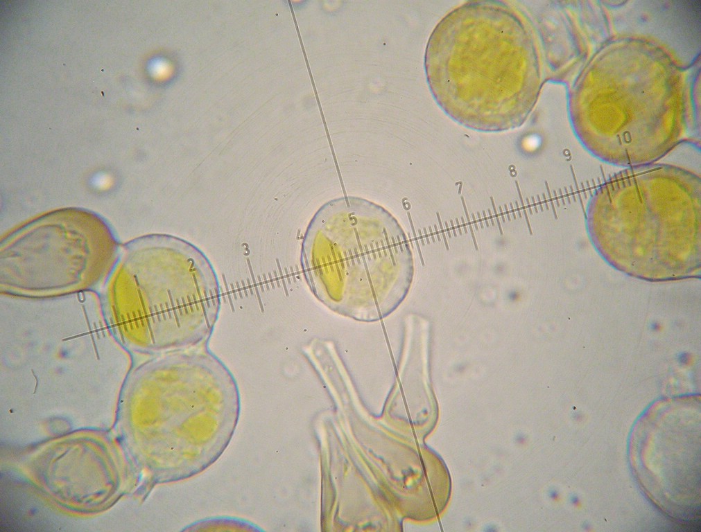Uredosporen gelblich bis blassbraun, eiförmig bis rundlich, warzig, 21-25 x 19-24 µm, mit zahlreichen kopfigen bis keuligen, gelblichen bis braunen Paraphysen untermischt