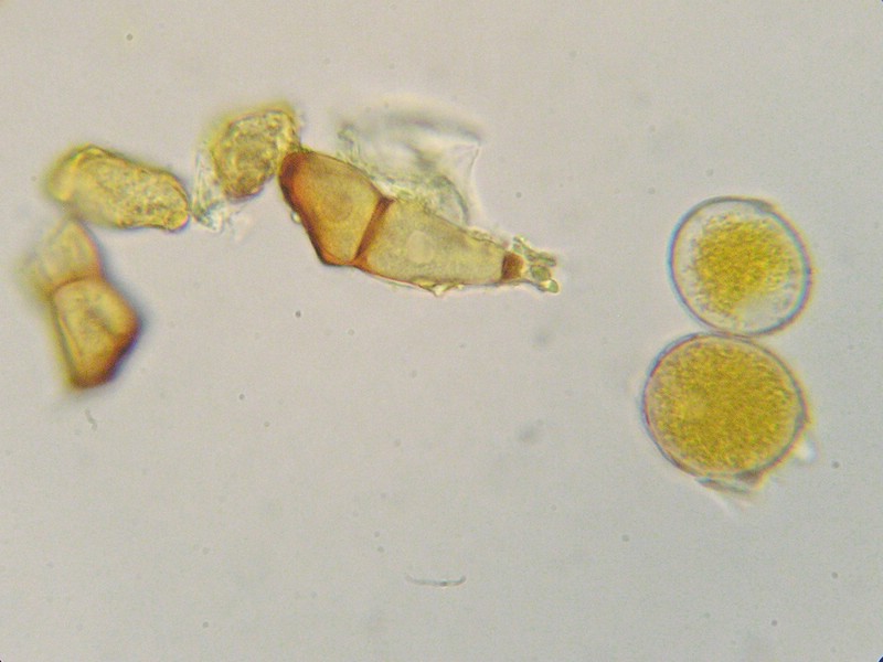 Teliosporen 25-27 x 20-23 µm, am Scheitel auf bis zu 4 µm verdickt