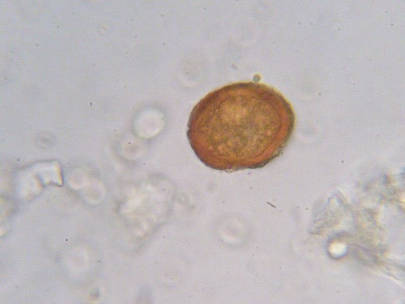 Aeziosporen braun, dickwandig (bis 4 µm)