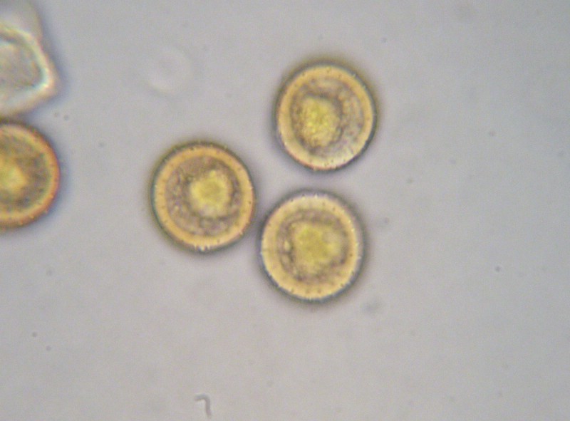 Sporenwand stachelig