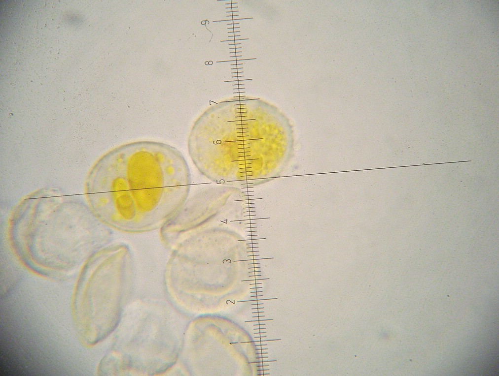 Uredosporen stachelwarzig; 21-23 x 18-21 µm