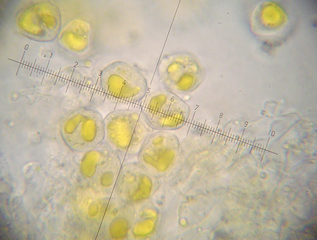 Aeciosporen 19-21 x 15-16 µm, sehr fein und dichtwarzig