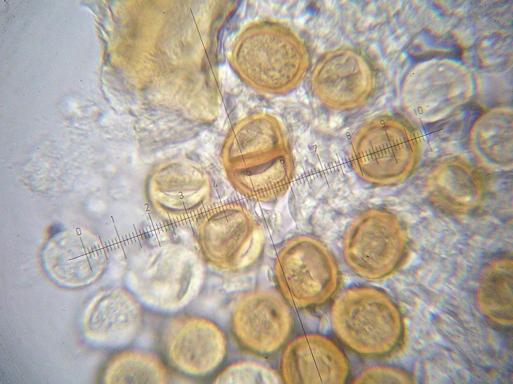 Uredosporen 20-24 x 17-19 µm; Teliosporen zweizellig, ellipsoid bis fast kugelig, beide Zellen gleich groß, 25-28 x 18-20 µm