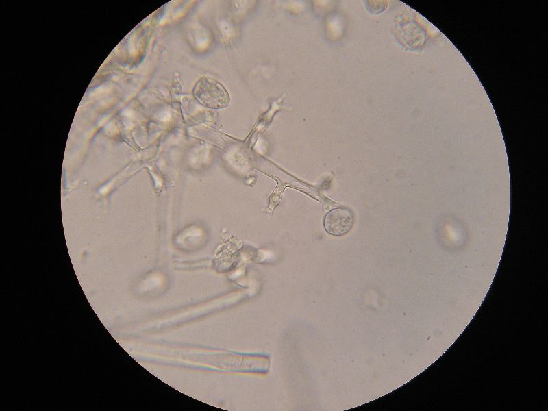 Konidienträger im oberen Teil mehrfach nacheinander +/- im rechten Winkel verzweigt; Endverzweigungen stumpf