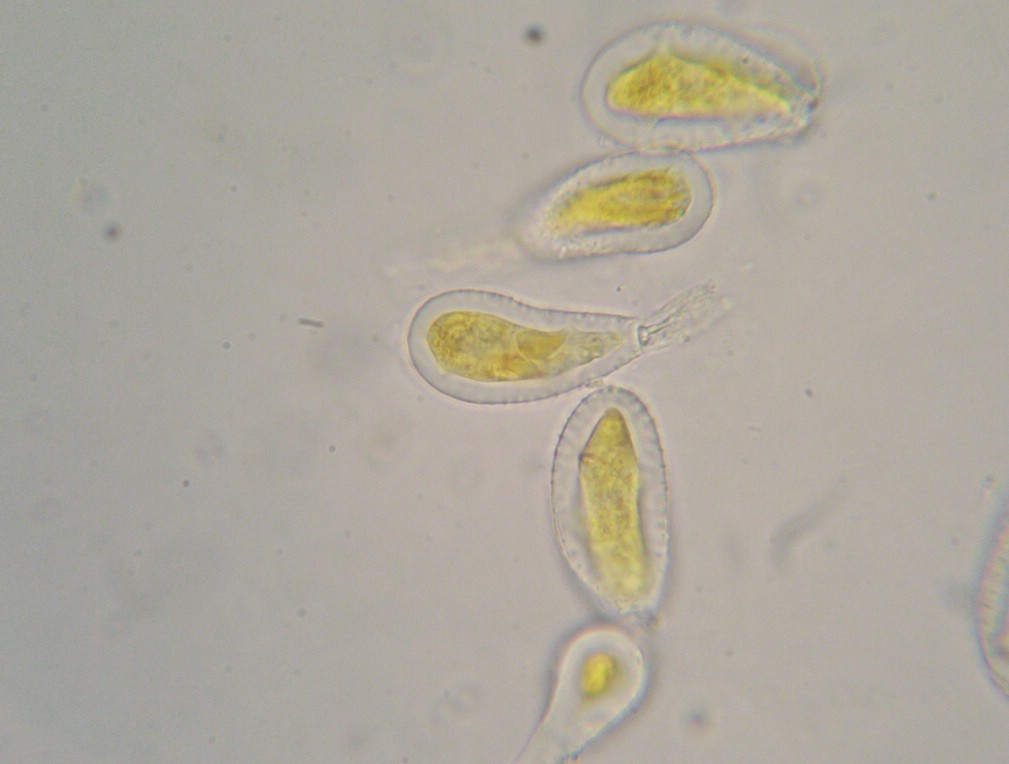 Wand der Uredosporen gleichmäßig dick (2-4 µm)