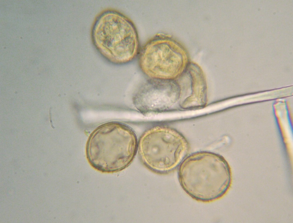 Uredosporen kugelig bis ellipsoid, stachelig, 23-26 x 20-22 µm